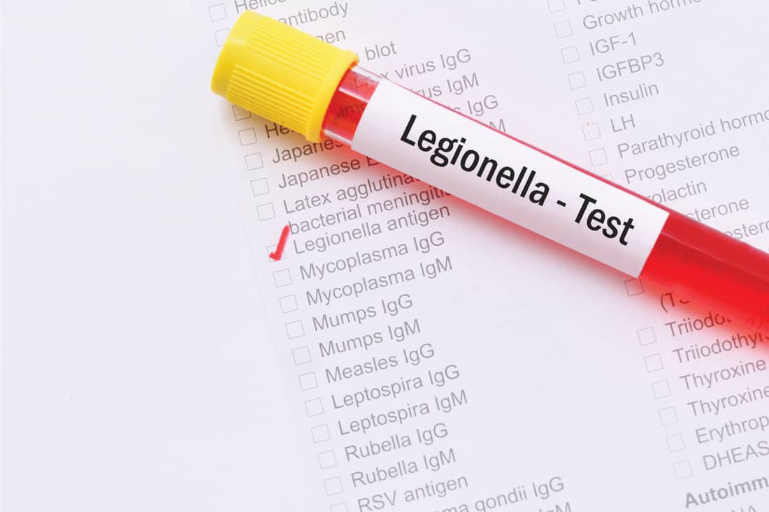 Blood sample with requisition form for Legionella antigen test
