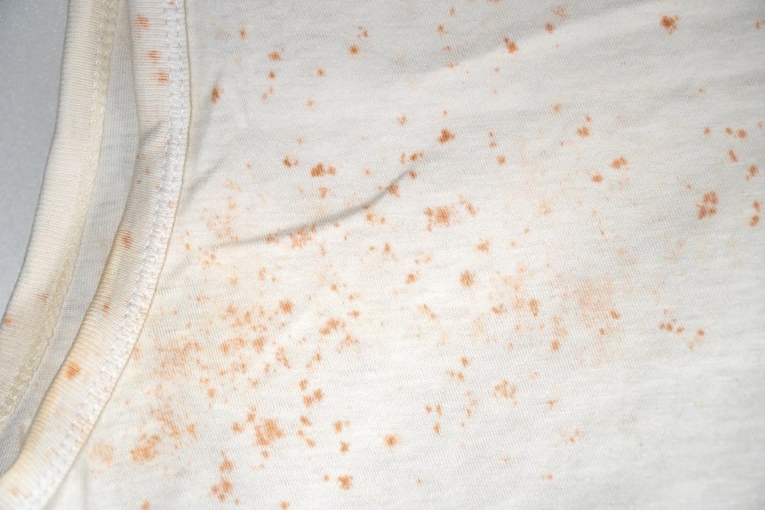What does mold on clothes smell like - Fungus on clothes with selective focus.